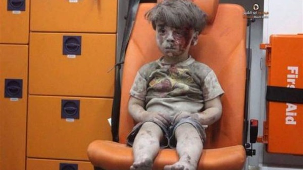 وفاة شقيق الطفل السوري عمران 1 وفاة شقيق الطفل السوري عمران