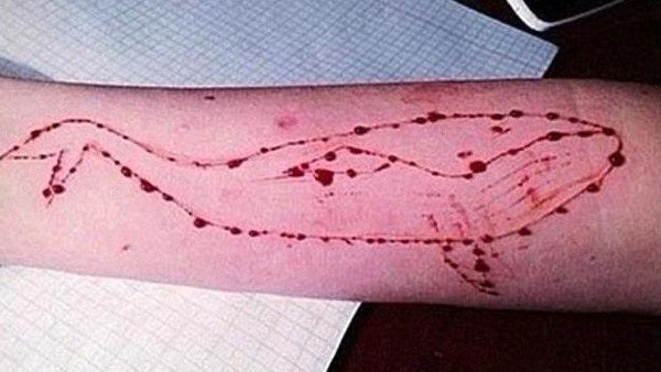 وفاة ضحية الحوت الأزرق بإيتاى البارود بعد وصوله لمركز السموم 1 الحوت الارزق