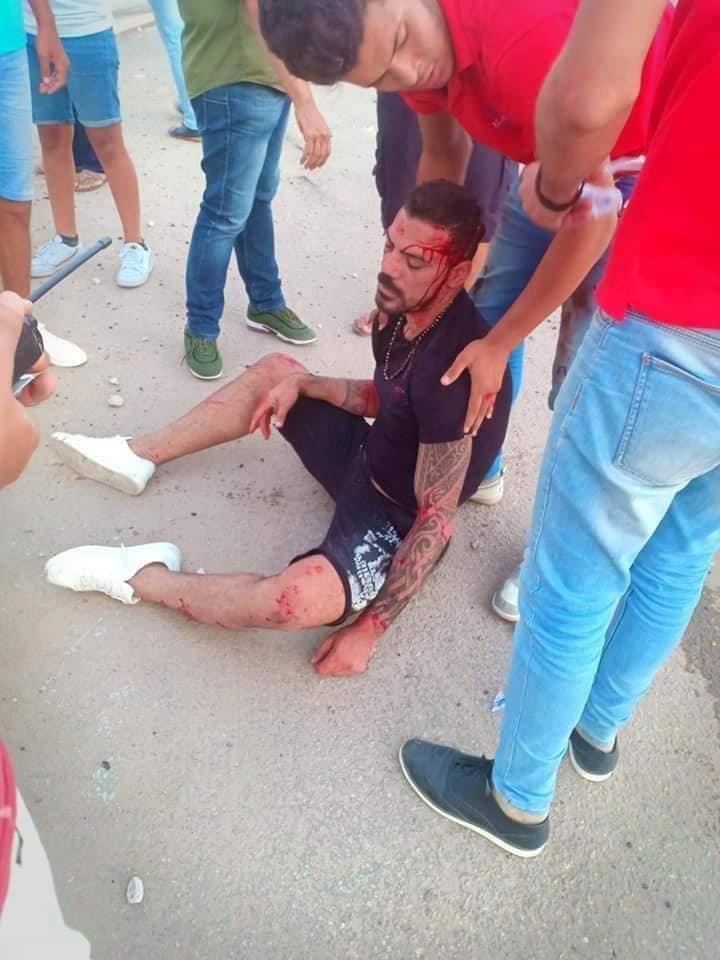 لاعب الزمالك يتعرض لحادث تصادم مروع 2 الزمالك